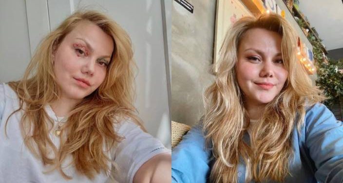 YouTuber Merve Veziroğlu Yıldırım, evli olduğu Yunus Yıldırım tarafından 32 yerinden bıçaklandı