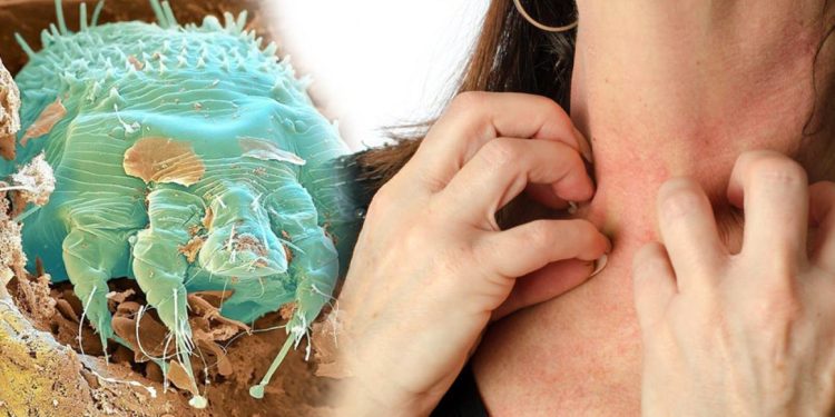 Uyuza karşı evde ne yapmalıyız? Dr. Feridun Kunak’tan uyuza karşı muhteşem karışım