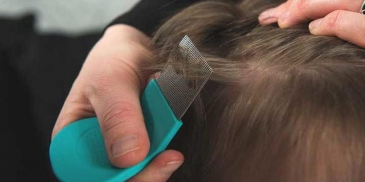 Bit nasıl temizlenir? En etkili bit temizleyen 3 doğal yöntem